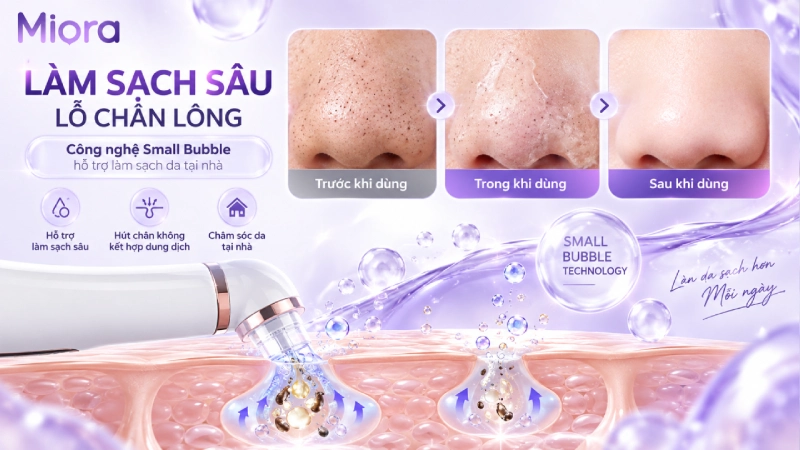 Công nghệ small bubble trên HY25 hoạt động bằng cách kết hợp dung dịch với đầu hút chân không để đưa dung dịch tiếp xúc với da và đồng thời hút lại chất lỏng cùng cặn trên bề mặt.