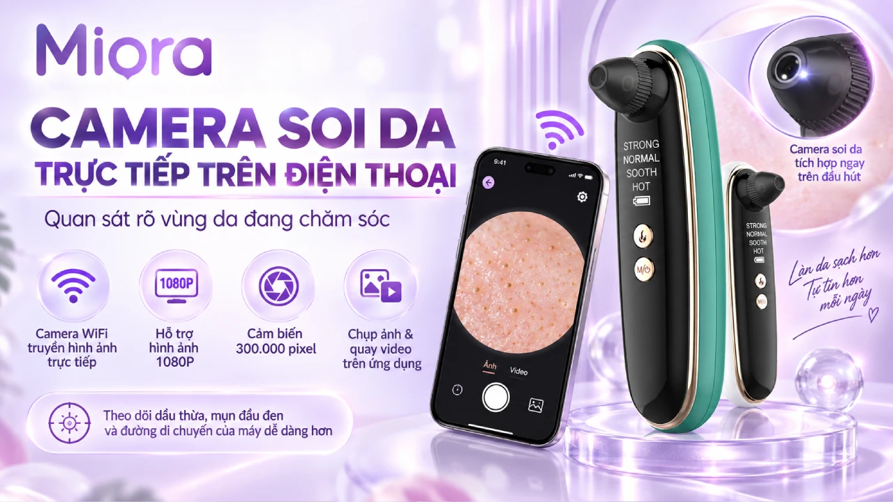 Camera 1080 giúp người xem có thể thấy rõ từng mụn trên mặt